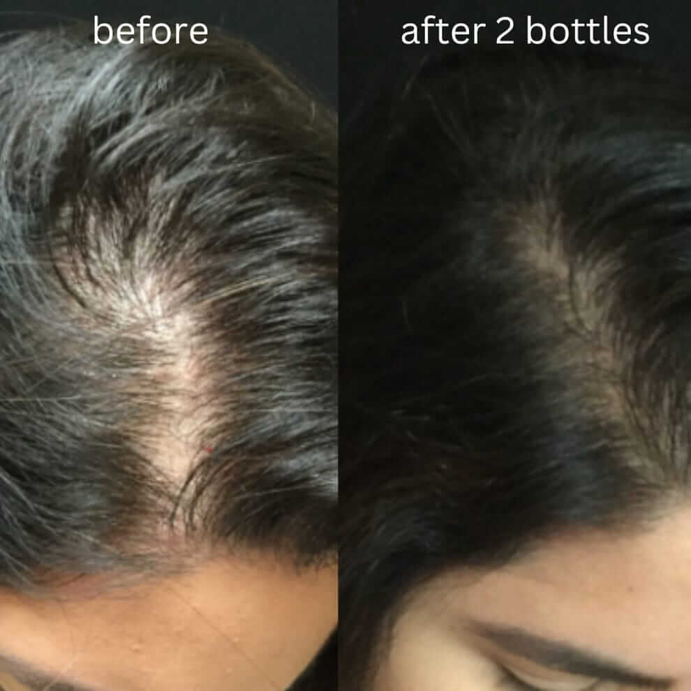 Tazeen-e-Zulf Herbal Hair Oil | Reduces Hair Fall & Promotes Hair Growth